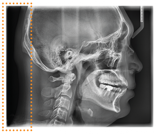 Vatech_2D-PaX_i-X_RAY_5