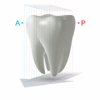 teeth insight