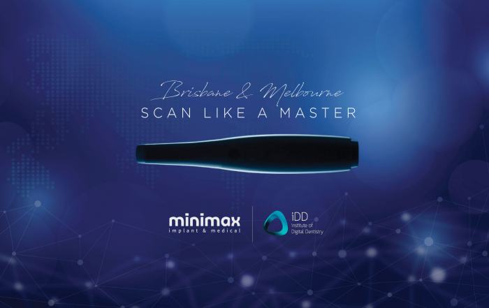Scan LIke a Master - Minimax & iDD