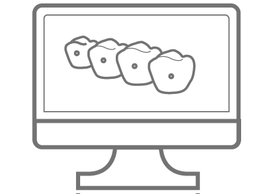 minimax medit clearcorrect