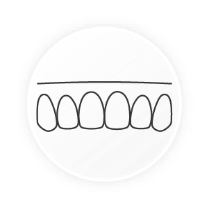 minimax medit clearcorrect