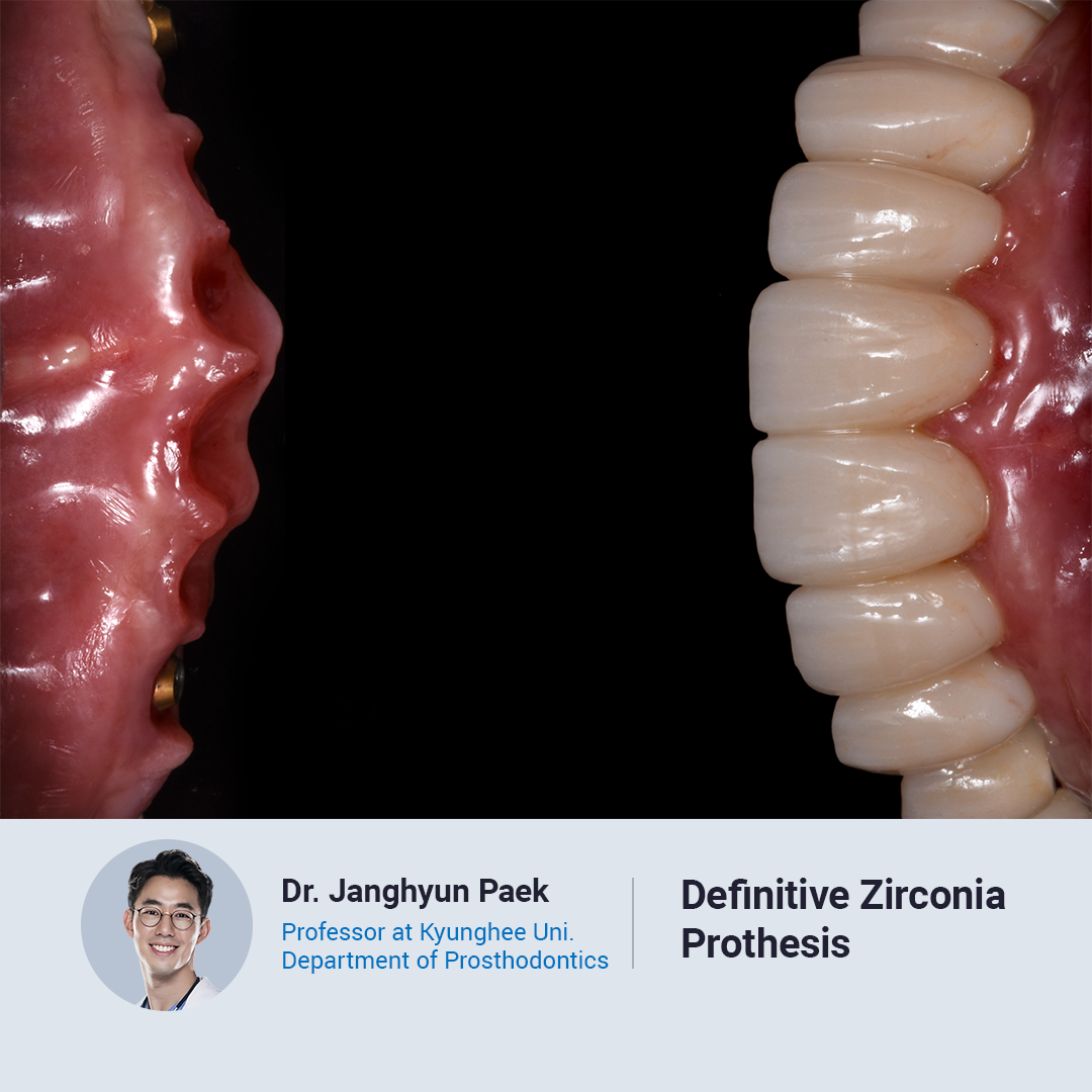 Digital Dentistry Consensus 2024 - Image 7