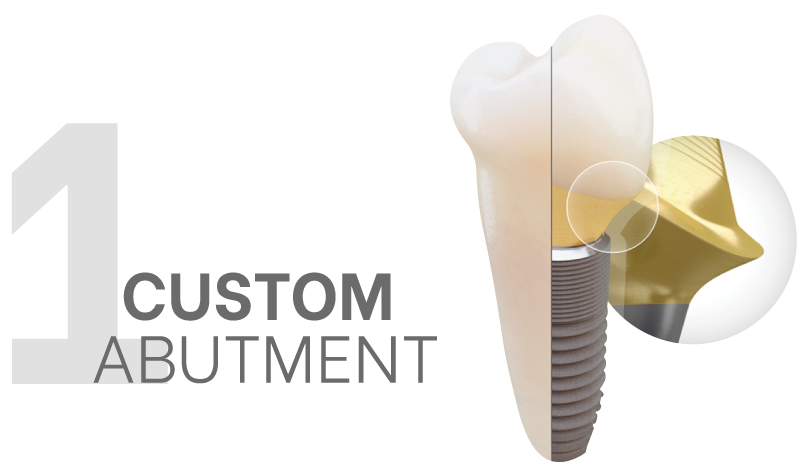 Maxfit (Custom Abutment)-1 Maxfit (Custom Abutment)-1