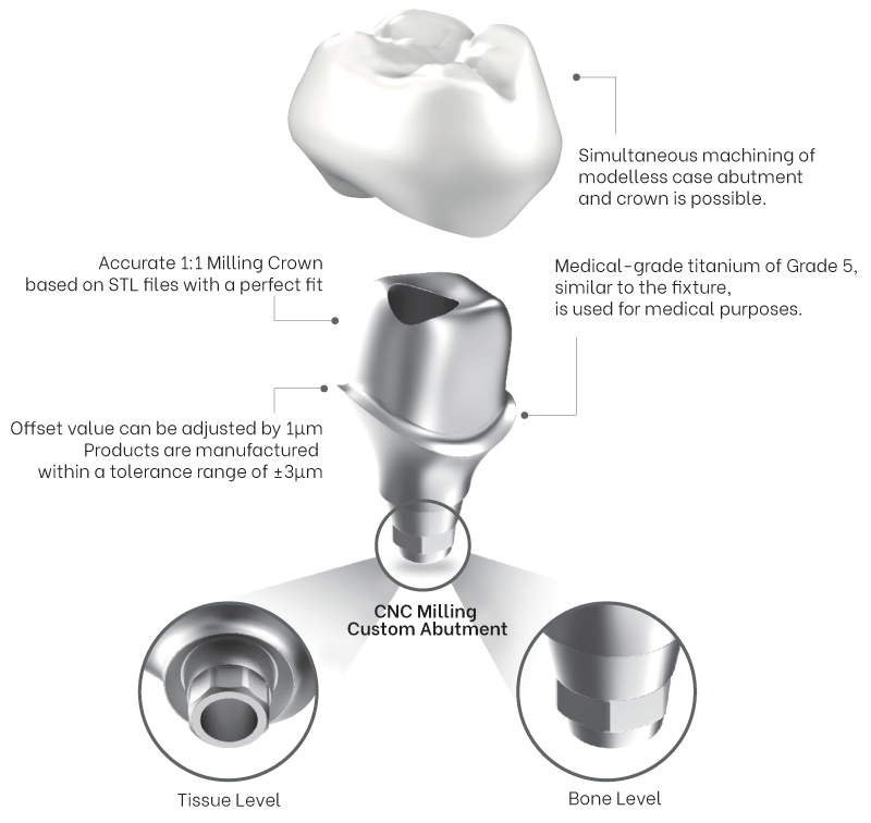 Maxfit (Custom Abutment)-3