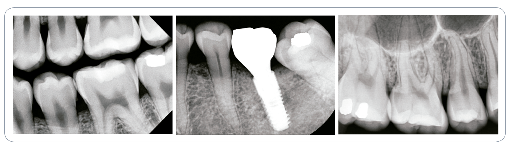 EzRay Premium 8