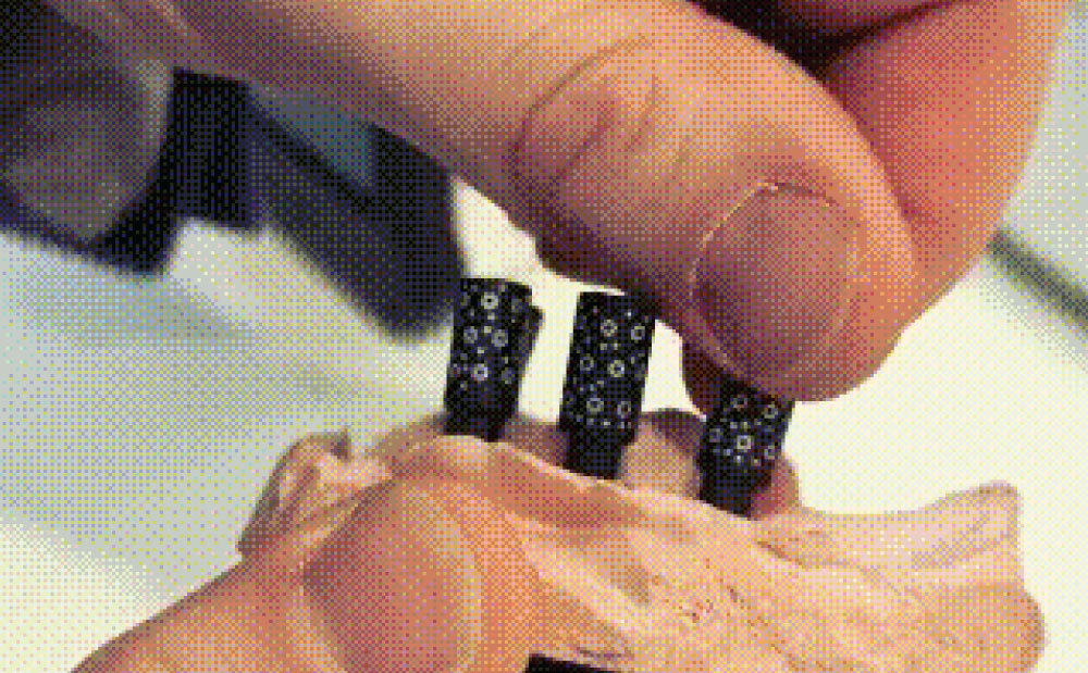 Tupel-3D-Intraoral-Scanner-Minimax-Implant-06.webp